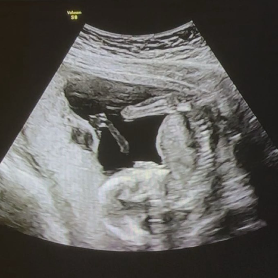 Photo shared by Cheyenne for their Babylist baby registry.