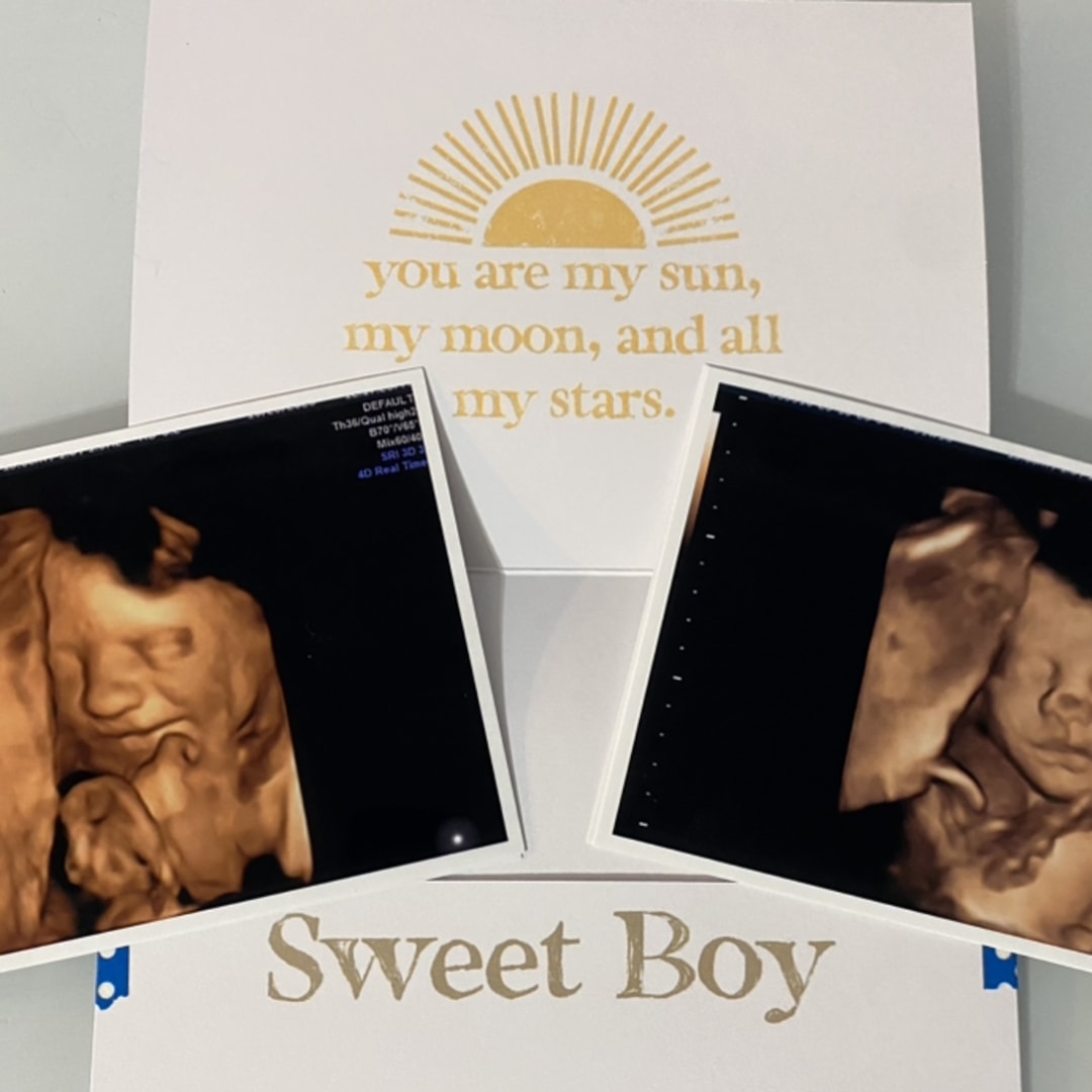 Photo shared by Abigail for their Babylist baby registry.