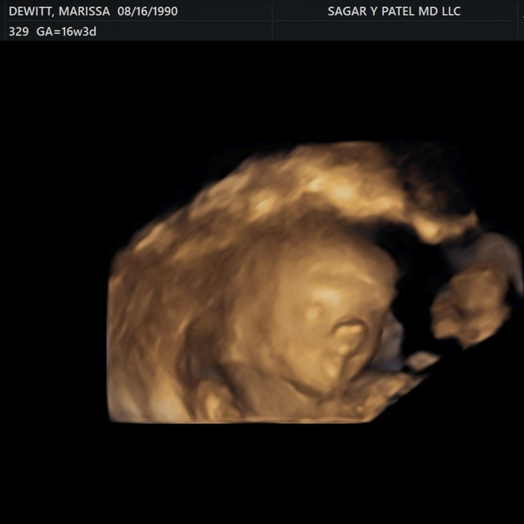 Photo shared by Marissa for their Babylist baby registry.