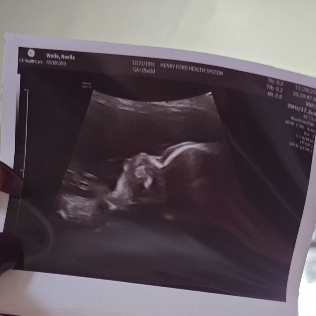 Photo shared by Noelle for their Babylist baby registry.