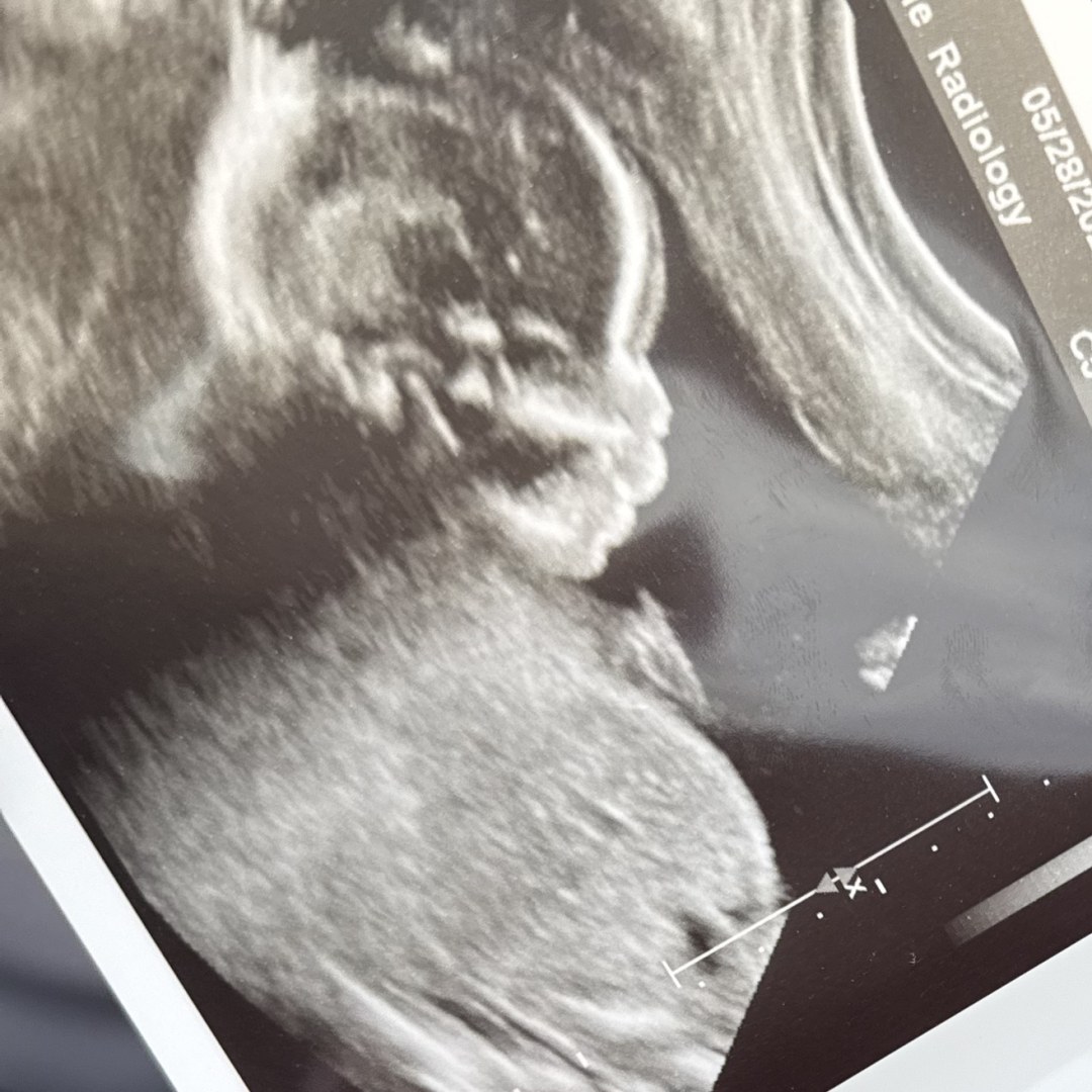 Photo shared by Gaby for their Babylist baby registry.