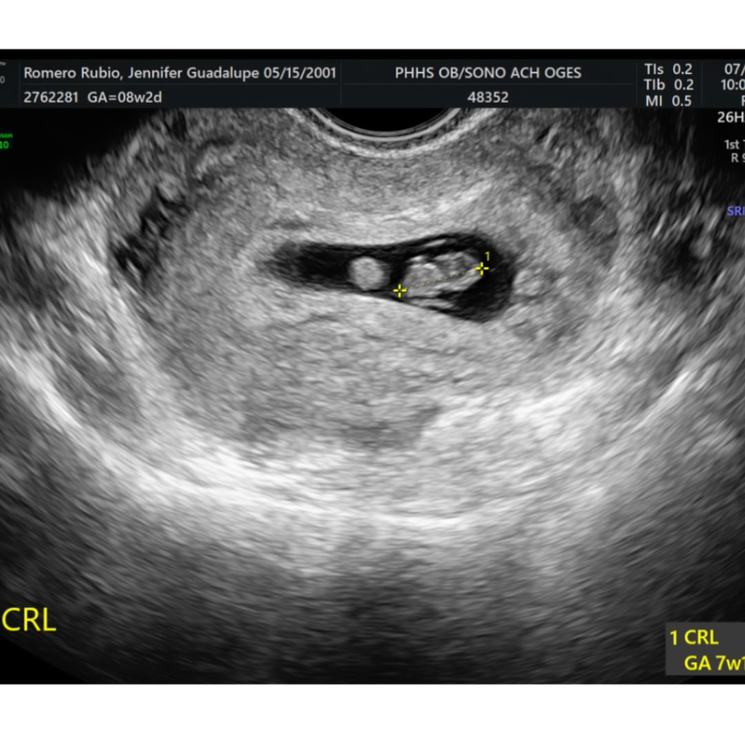 Photo shared by Jennifer for their Babylist baby registry.