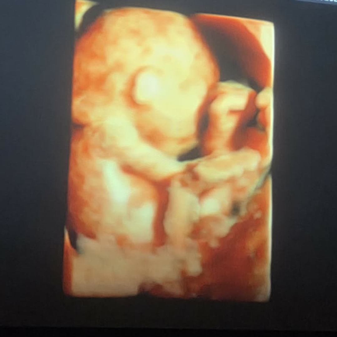 Photo shared by Emily for their Babylist baby registry.