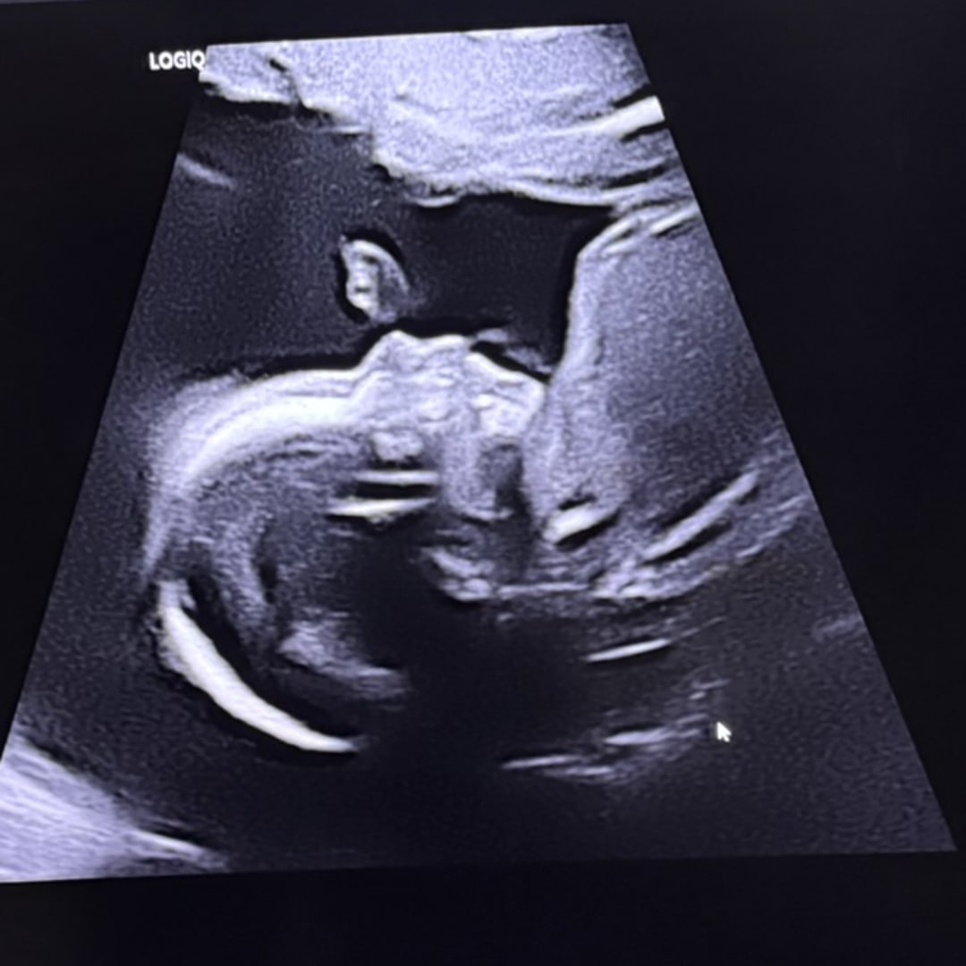 Photo shared by Emely for their Babylist baby registry.