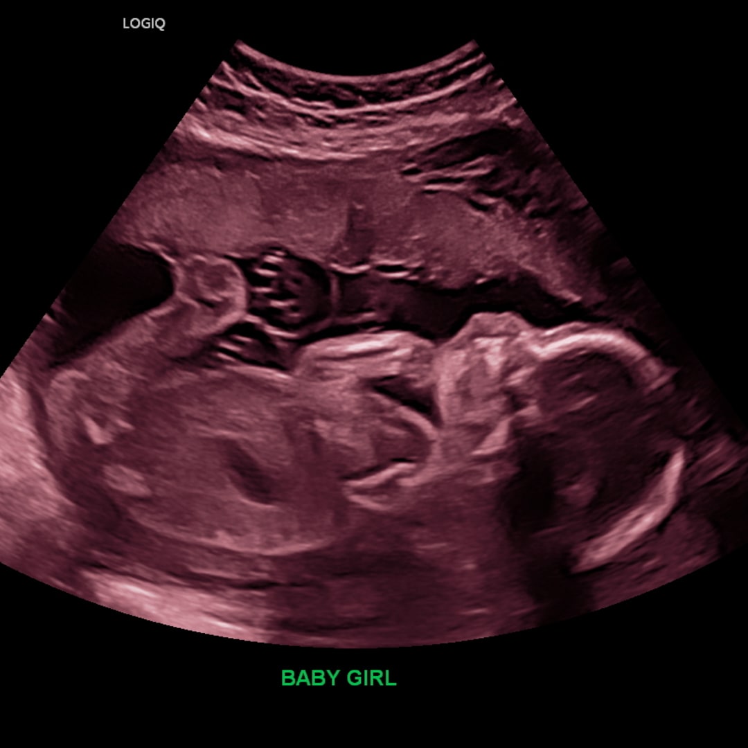 Photo shared by Shelby for their Babylist baby registry.