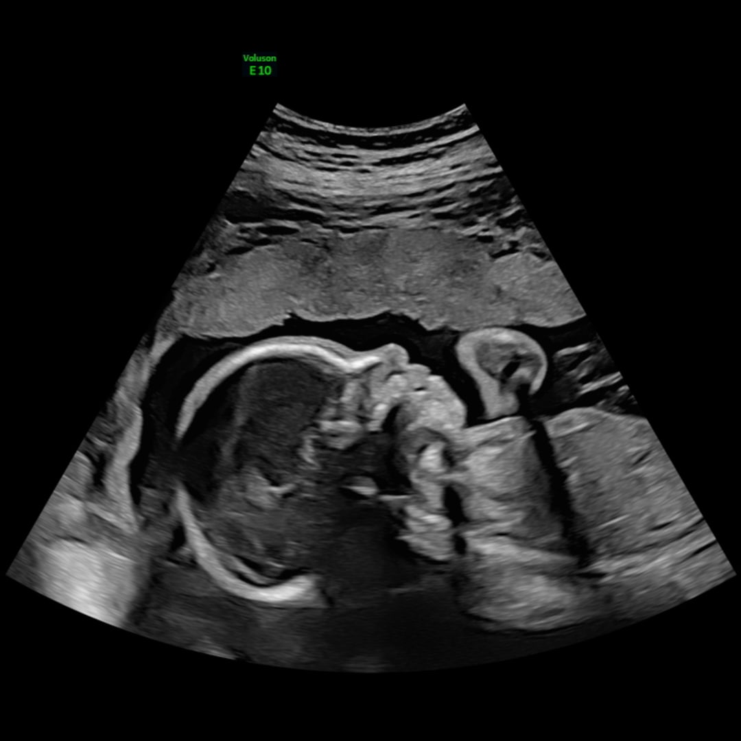 Photo shared by BreeAna for their Babylist baby registry.