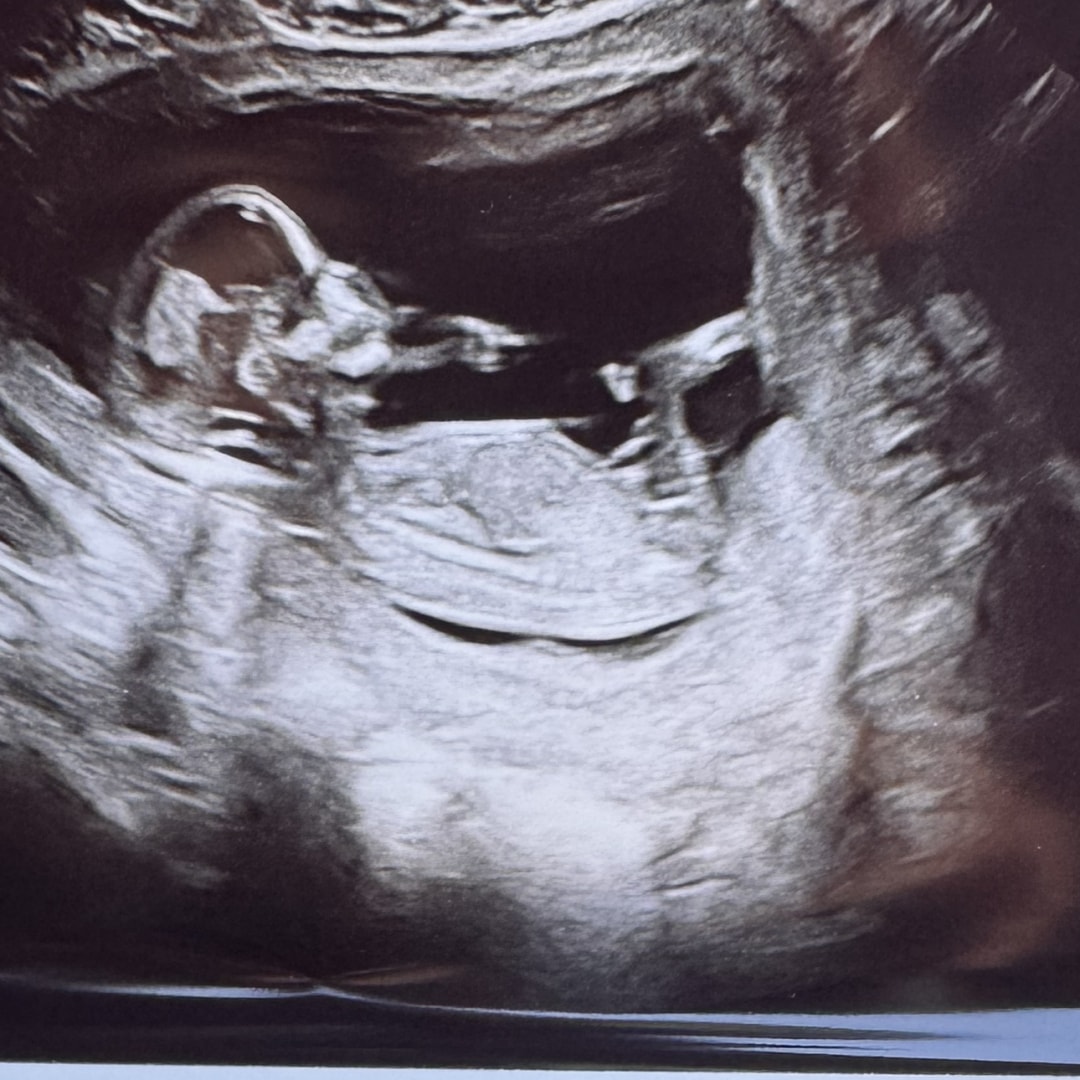 Photo shared by Katelyn for their Babylist baby registry.