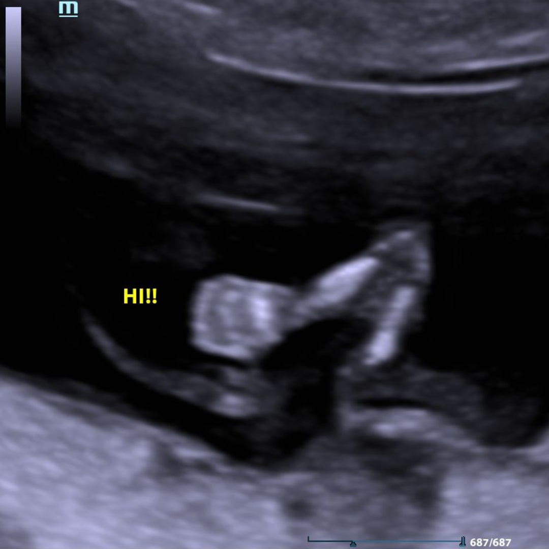 Photo shared by Rachel for their Babylist baby registry.