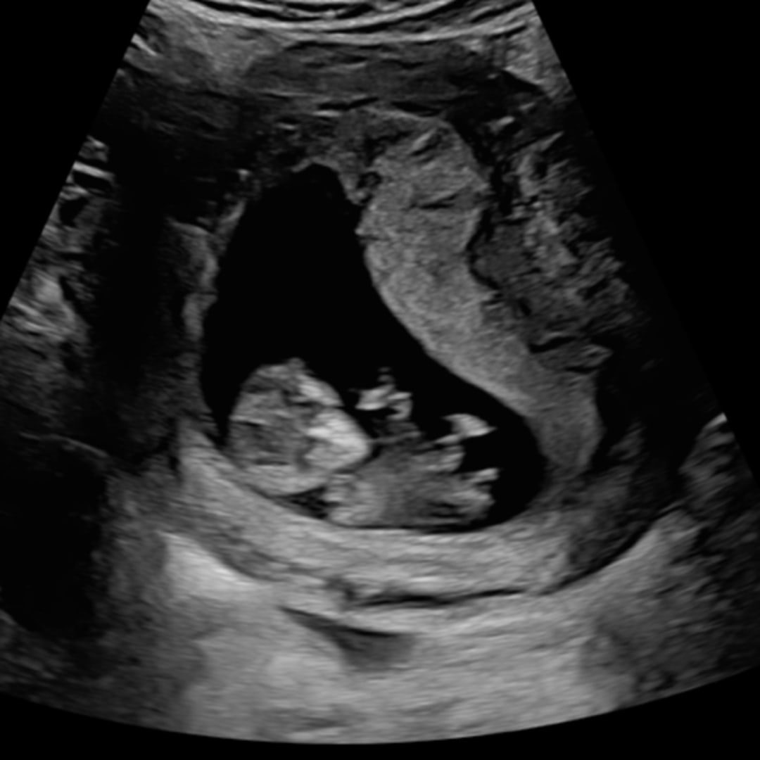 Photo shared by Lilee for their Babylist baby registry.