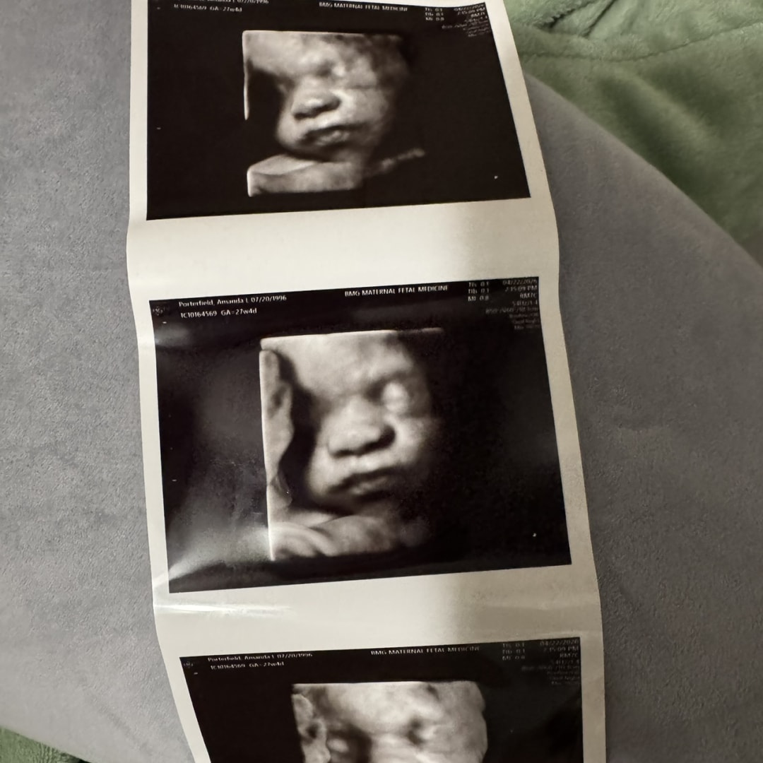 Photo shared by Amanda for their Babylist baby registry.