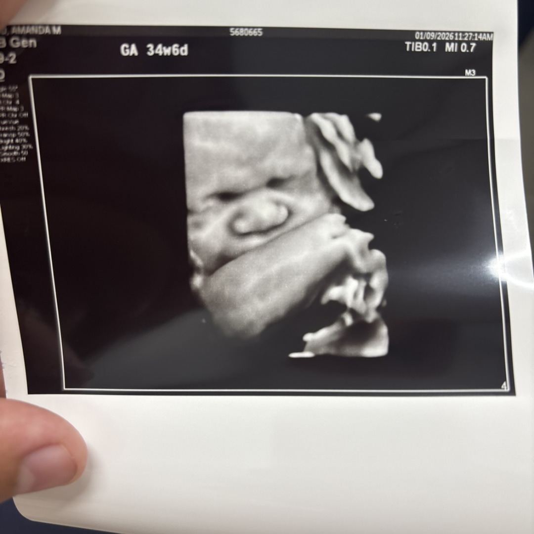 Photo shared by Amanda for their Babylist baby registry.