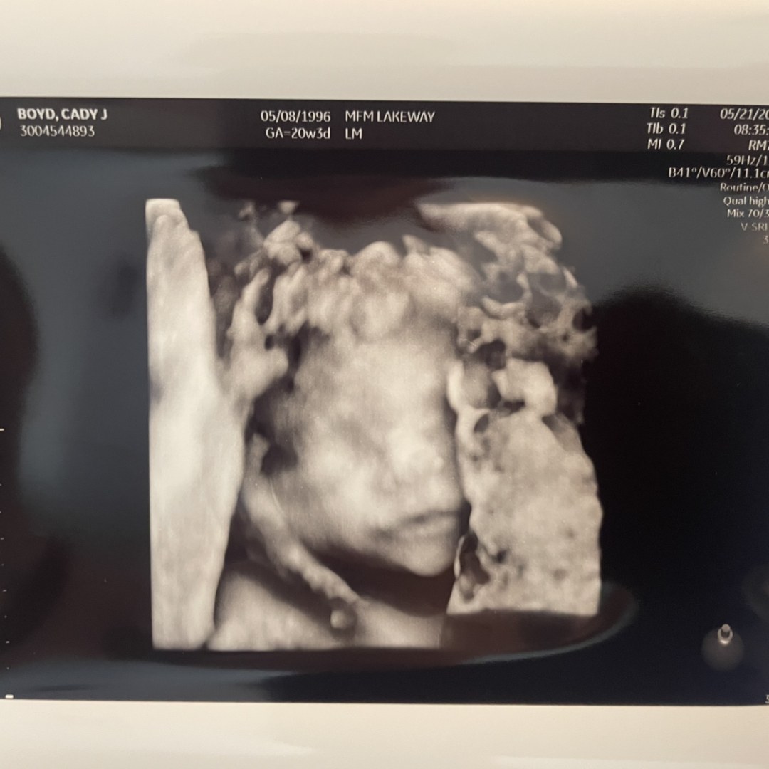 Photo shared by Cady for their Babylist baby registry.