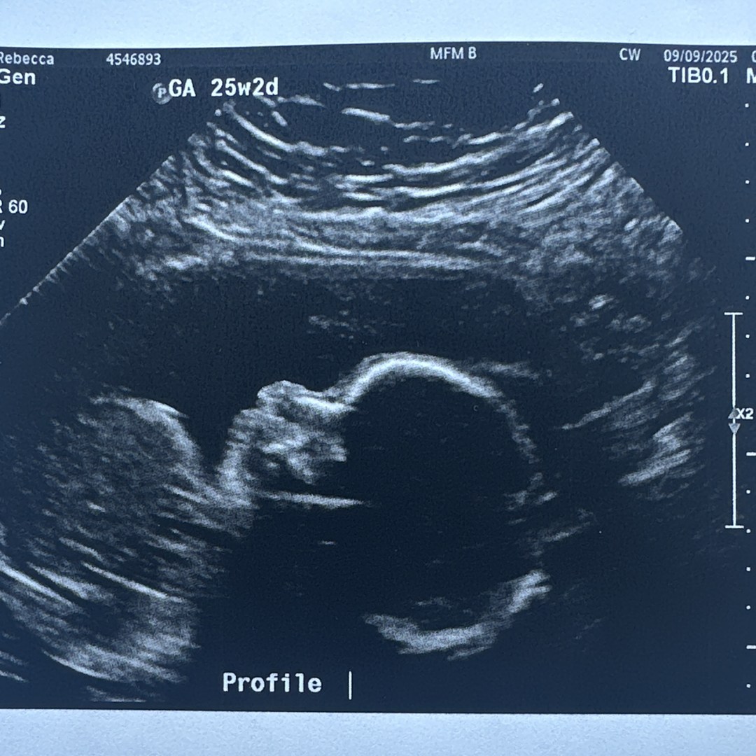 Photo shared by Rebecca for their Babylist baby registry.