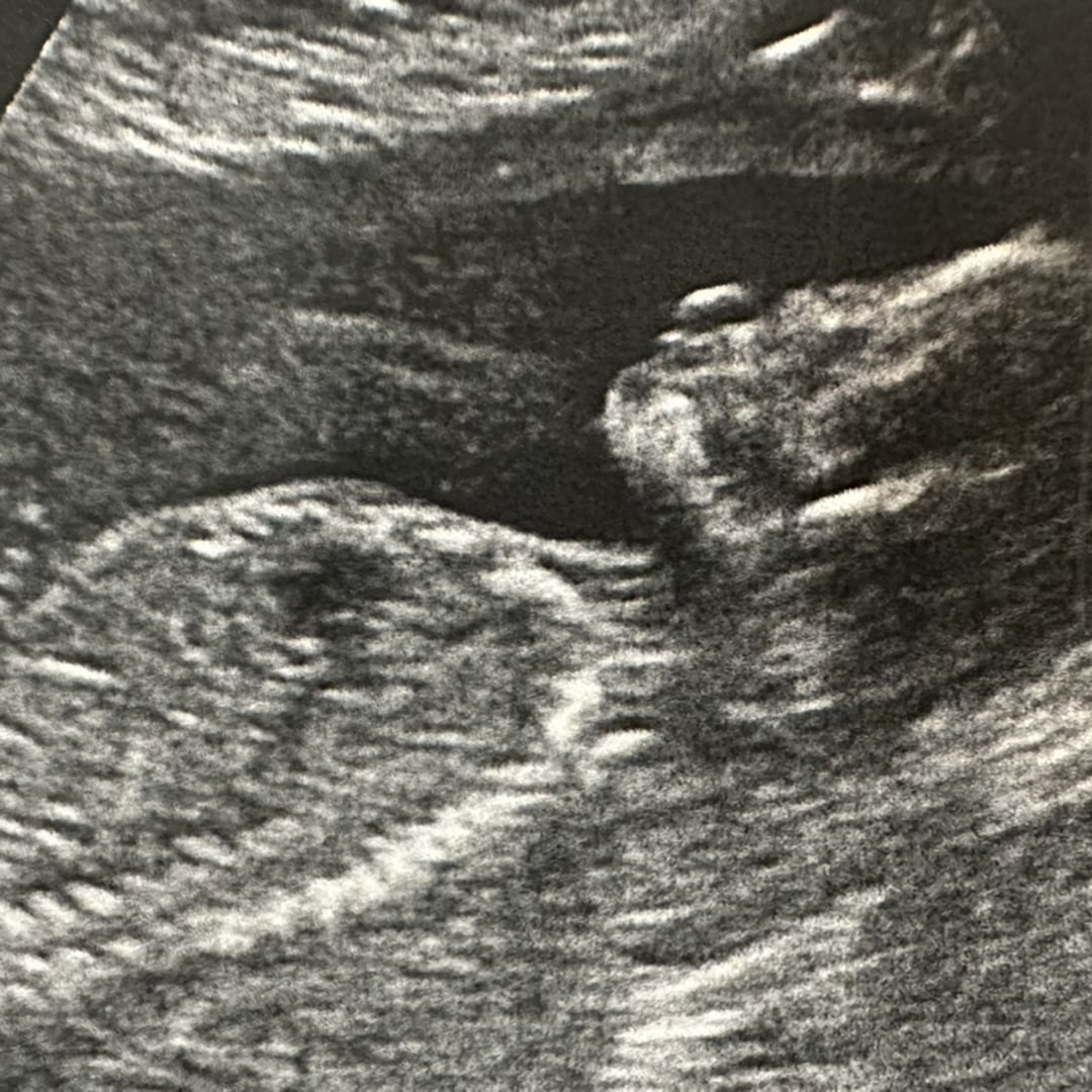 Photo shared by Madelyne for their Babylist baby registry.