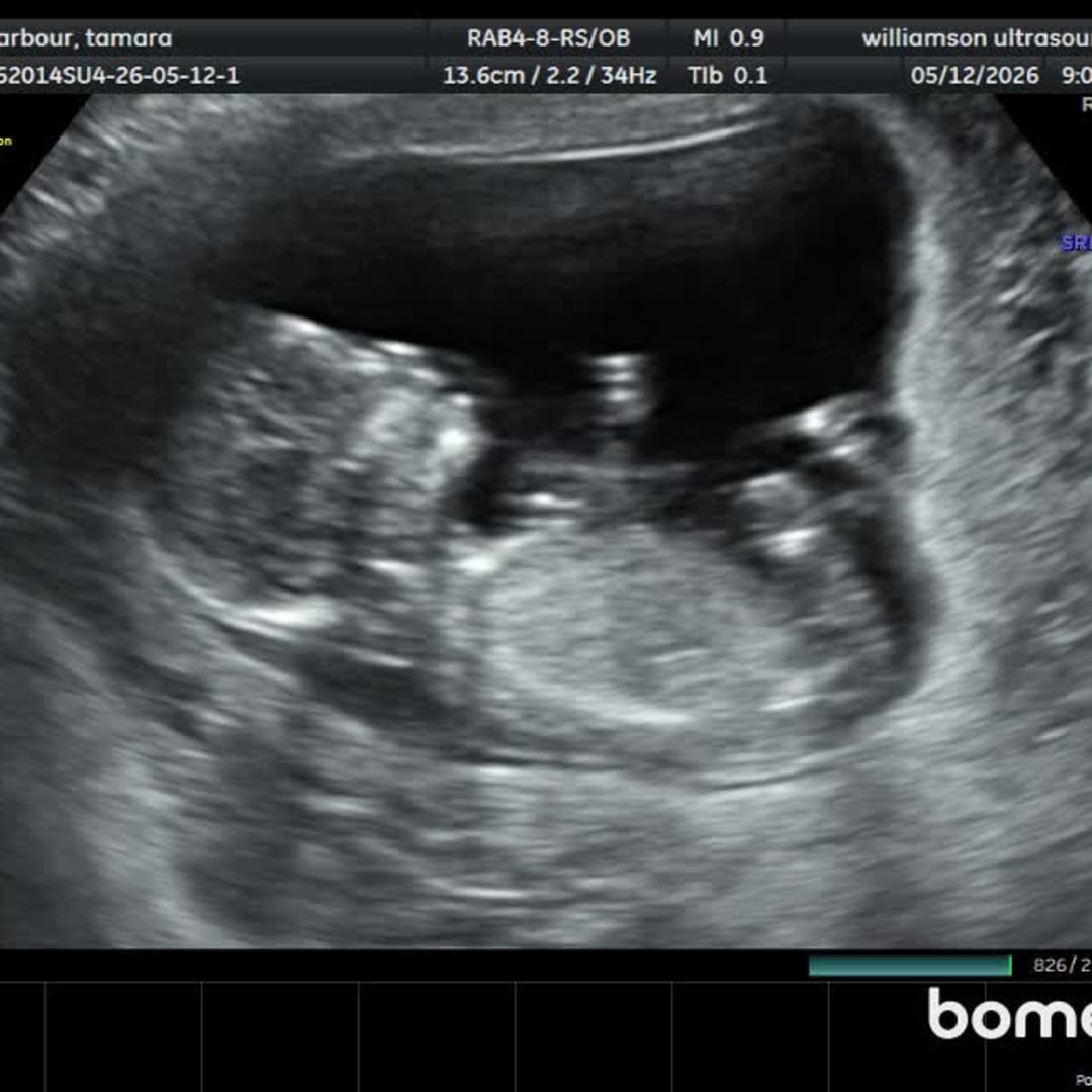 Photo shared by Tamara for their Babylist baby registry.