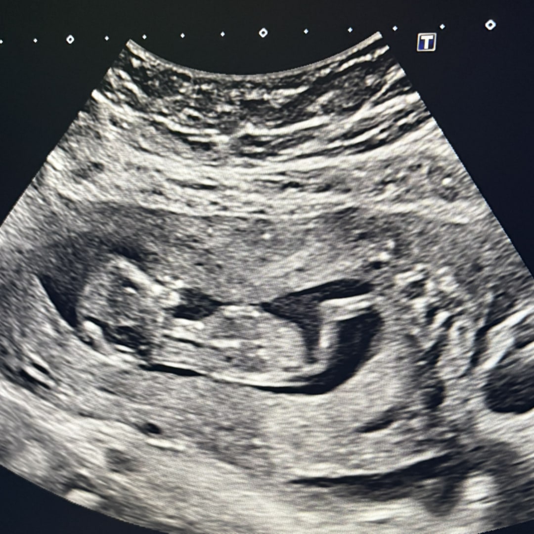 Photo shared by Averie for their Babylist baby registry.