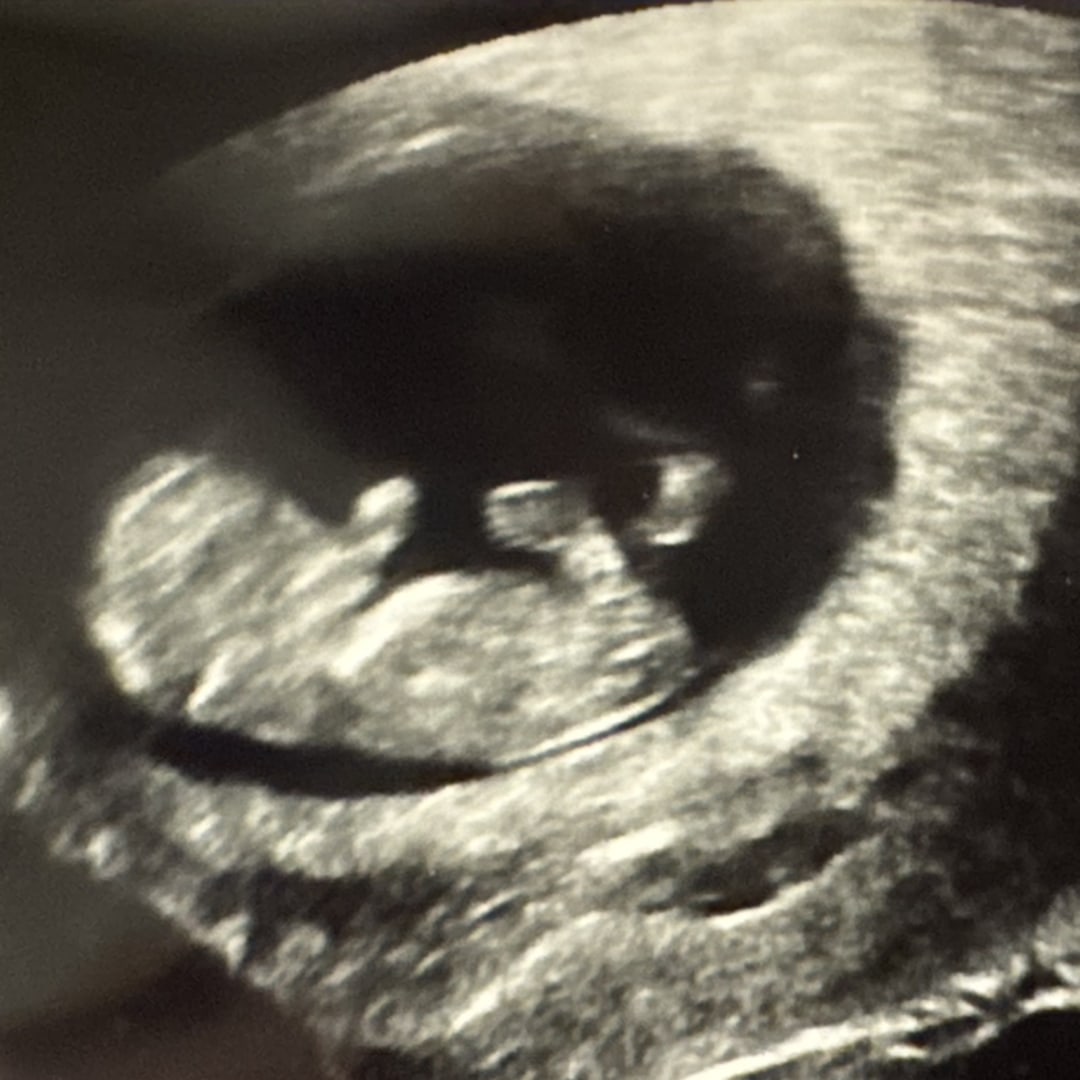 Photo shared by Jenny for their Babylist baby registry.