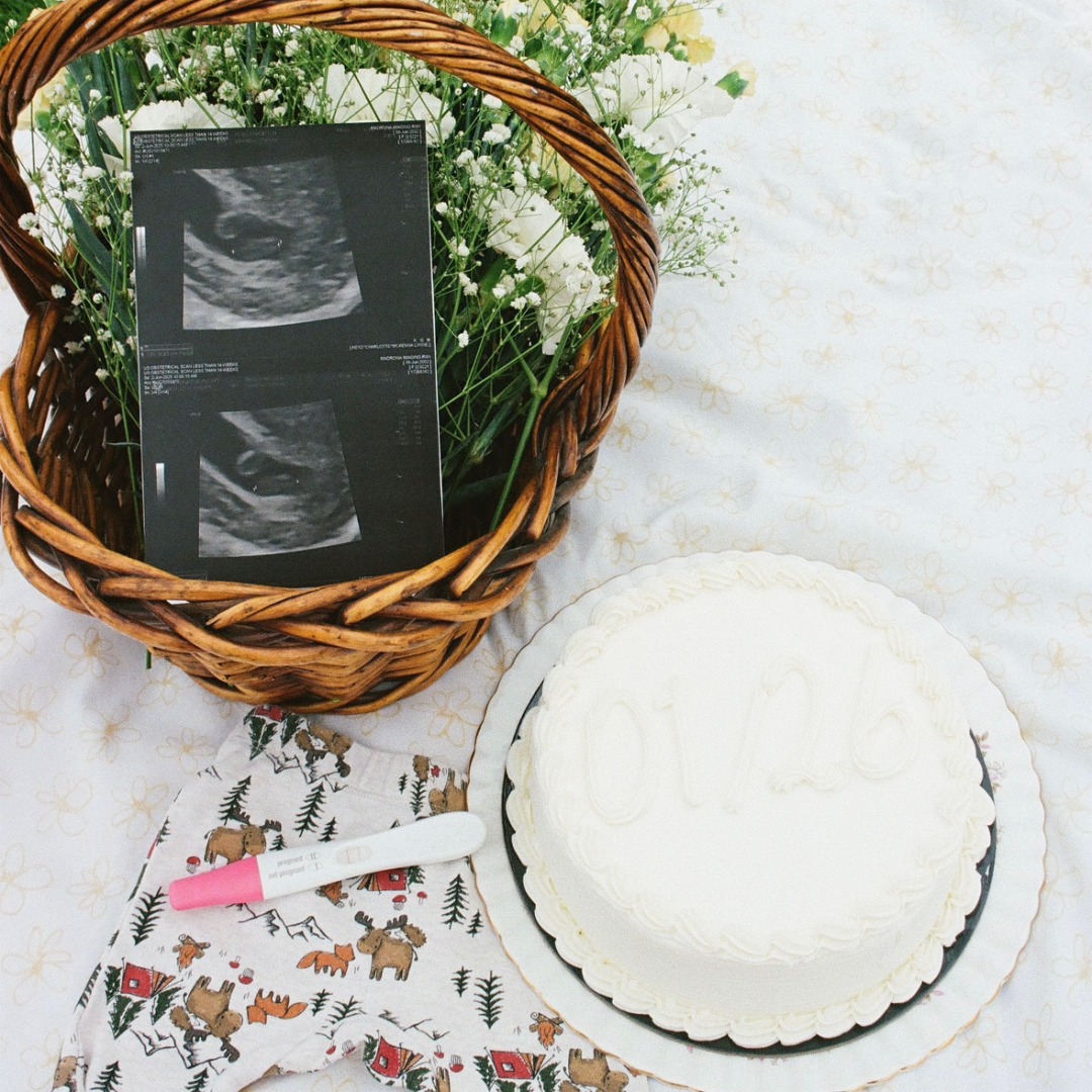 Photo shared by Charlotte for their Babylist baby registry.