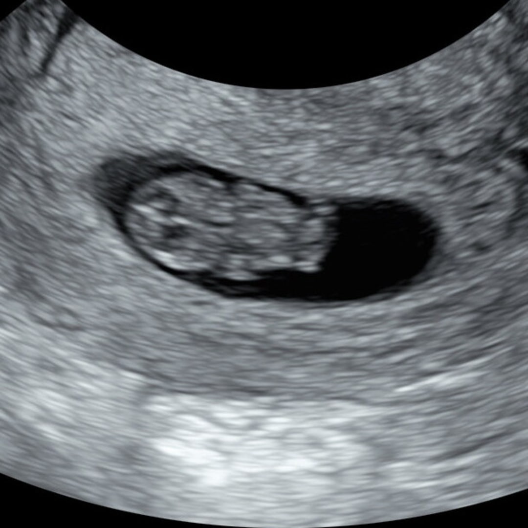 Photo shared by Melissa for their Babylist baby registry.