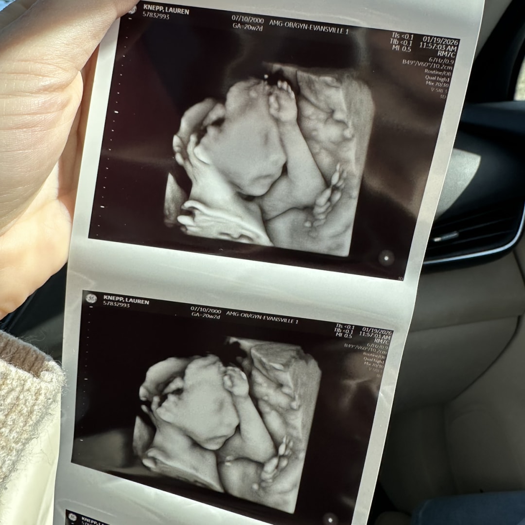 Photo shared by Lauren for their Babylist baby registry.