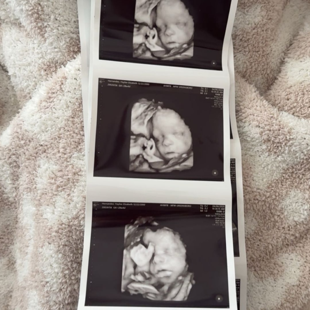 Photo shared by Haylee for their Babylist baby registry.