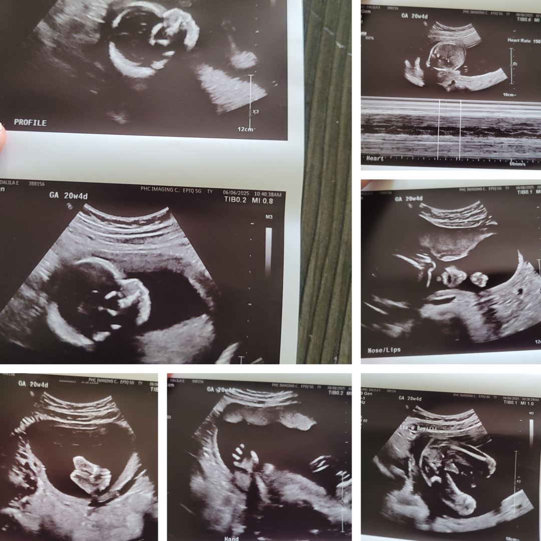 Photo shared by Dalila for their Babylist baby registry.