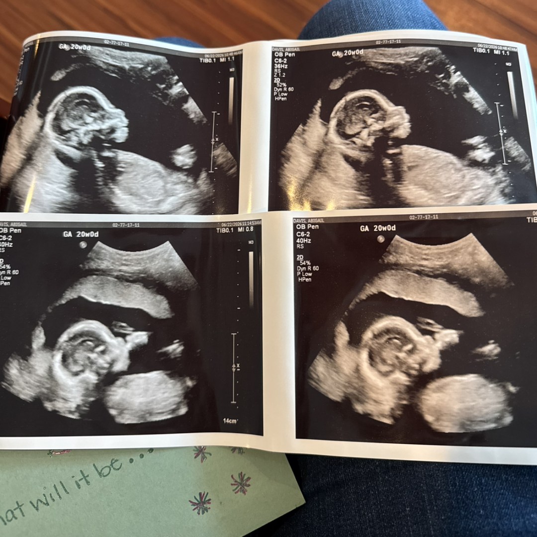 Photo shared by Abigail for their Babylist baby registry.