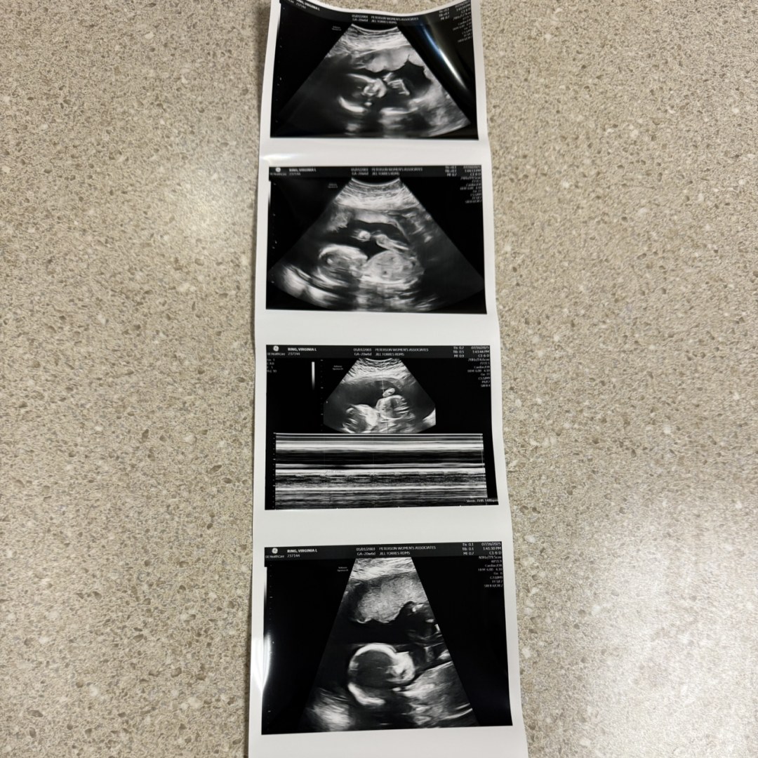 Photo shared by Virginia for their Babylist baby registry.