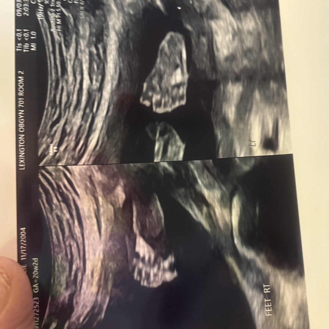 Photo shared by Leslie for their Babylist baby registry.