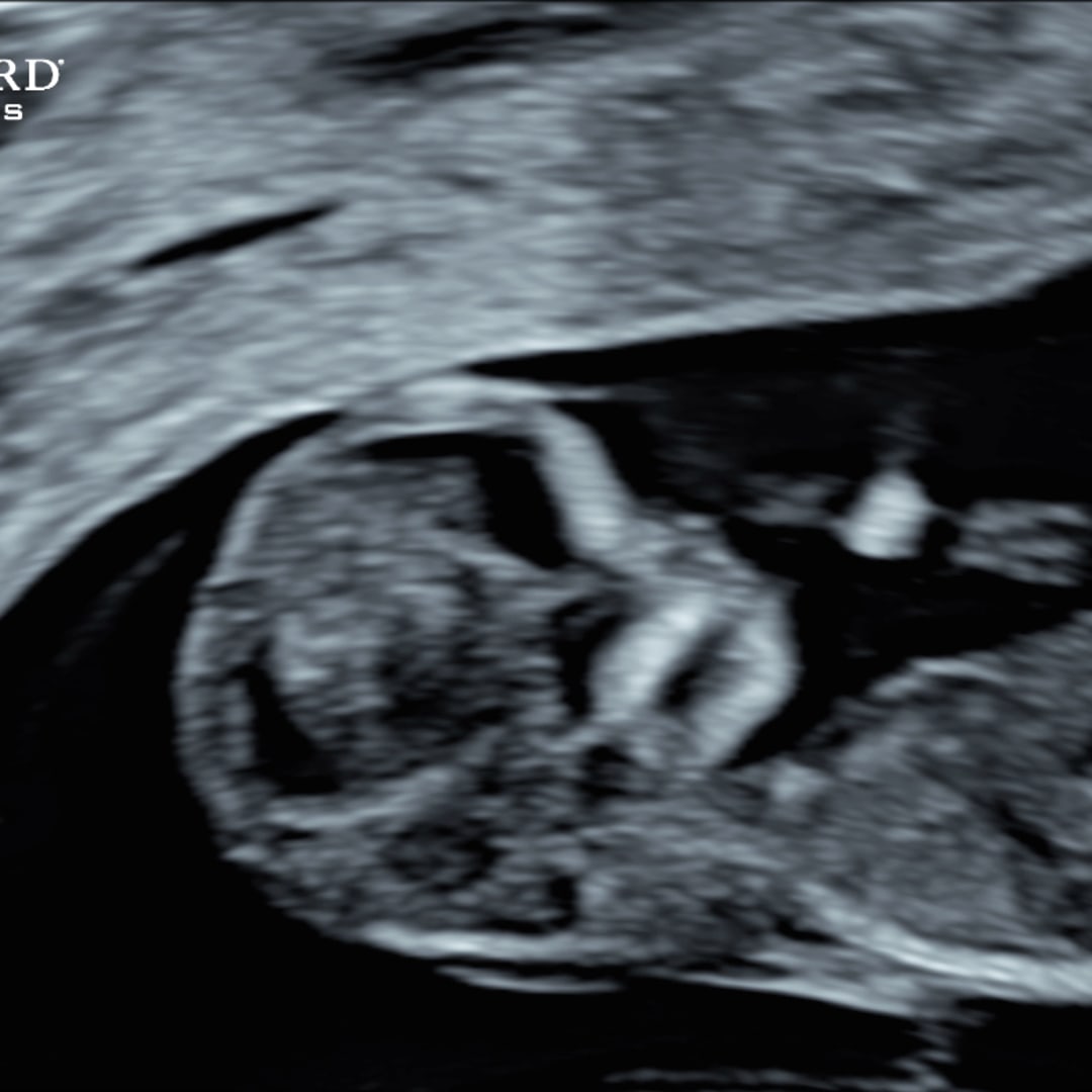 Photo shared by Tessa for their Babylist baby registry.