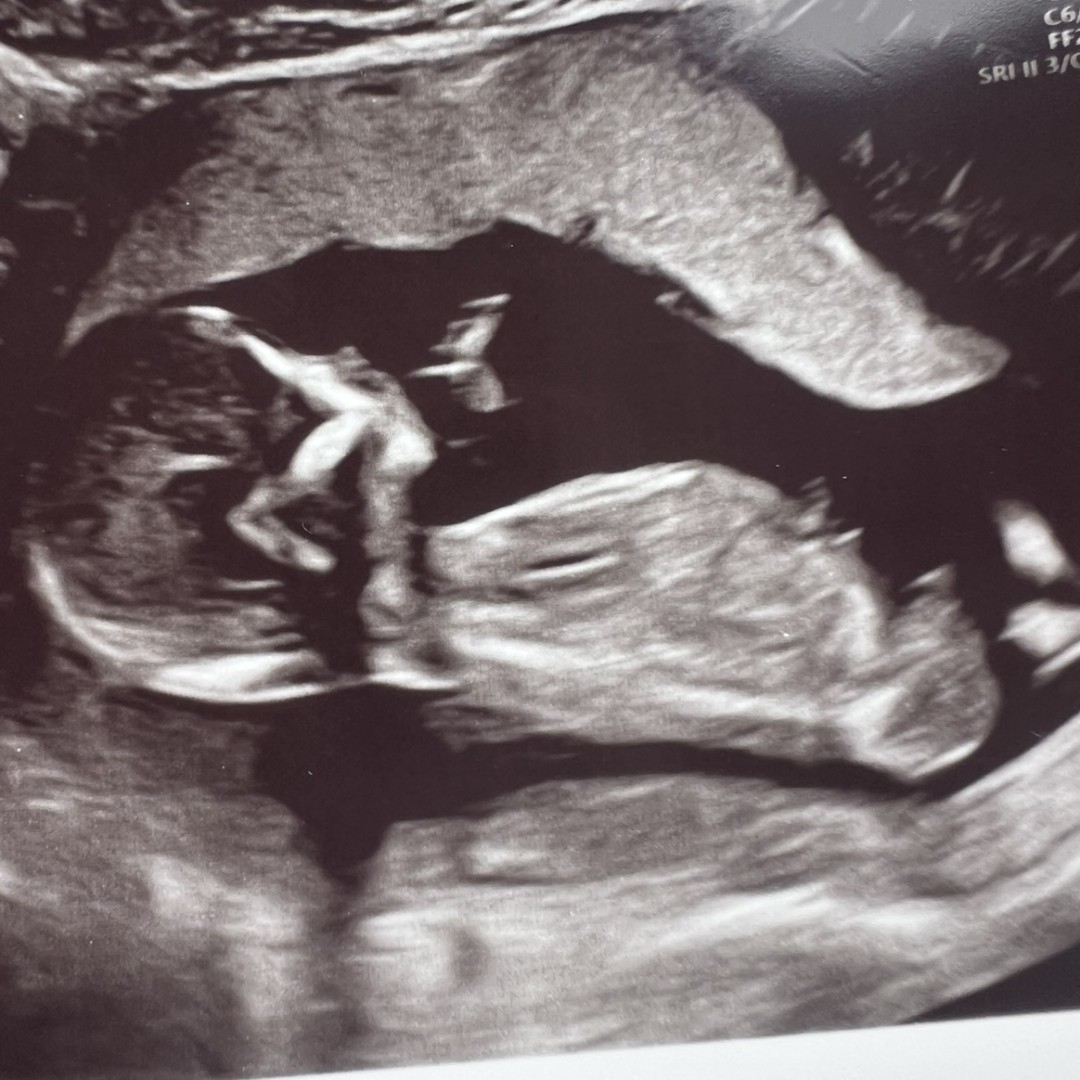 Photo shared by Kelley for their Babylist baby registry.