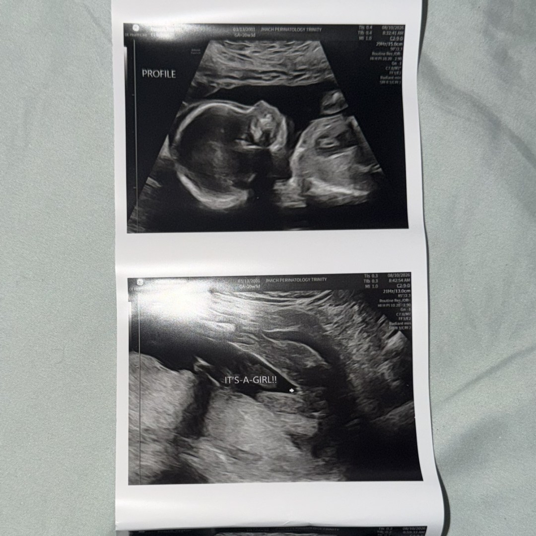 Photo shared by Peyton for their Babylist baby registry.