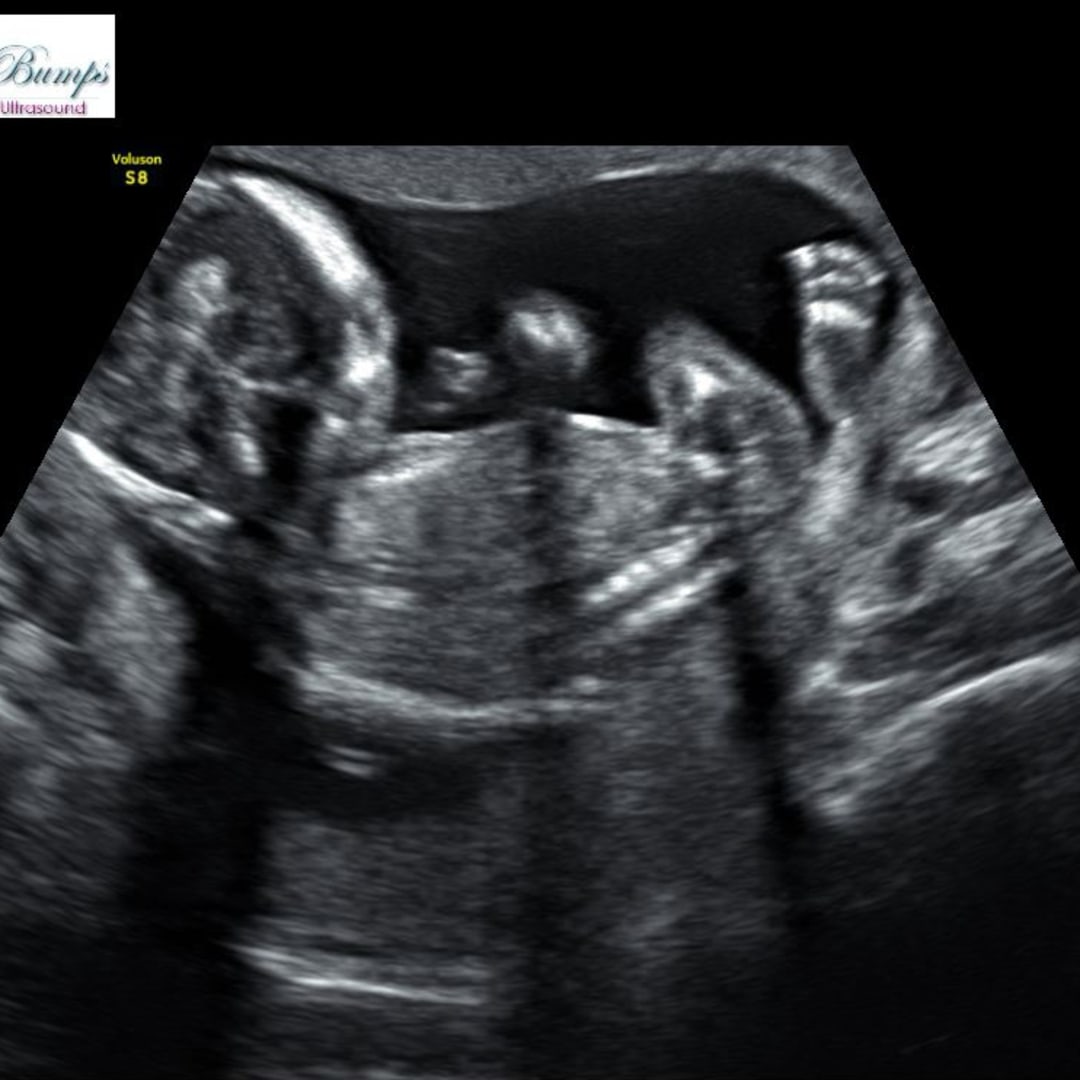 Photo shared by Kameron for their Babylist baby registry.