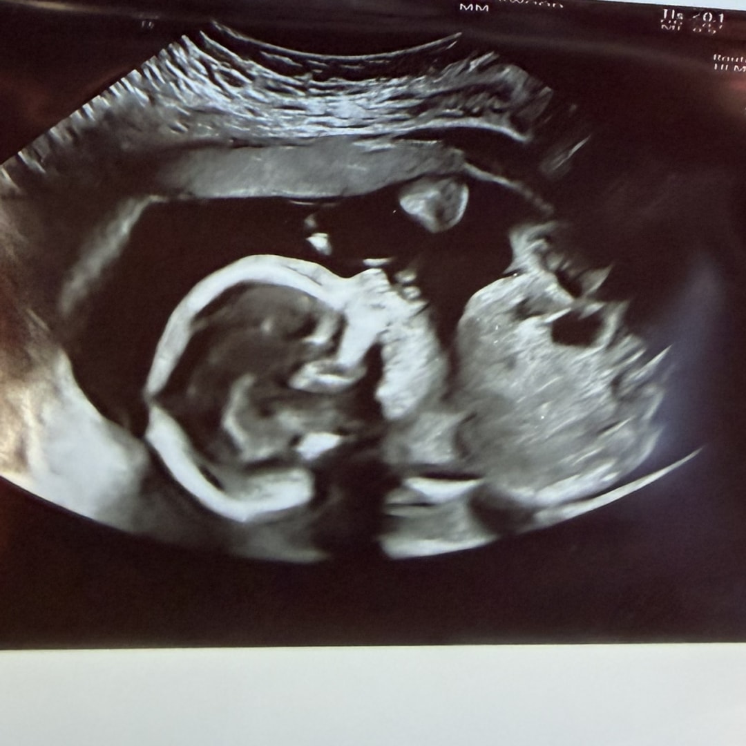 Photo shared by Allie for their Babylist baby registry.