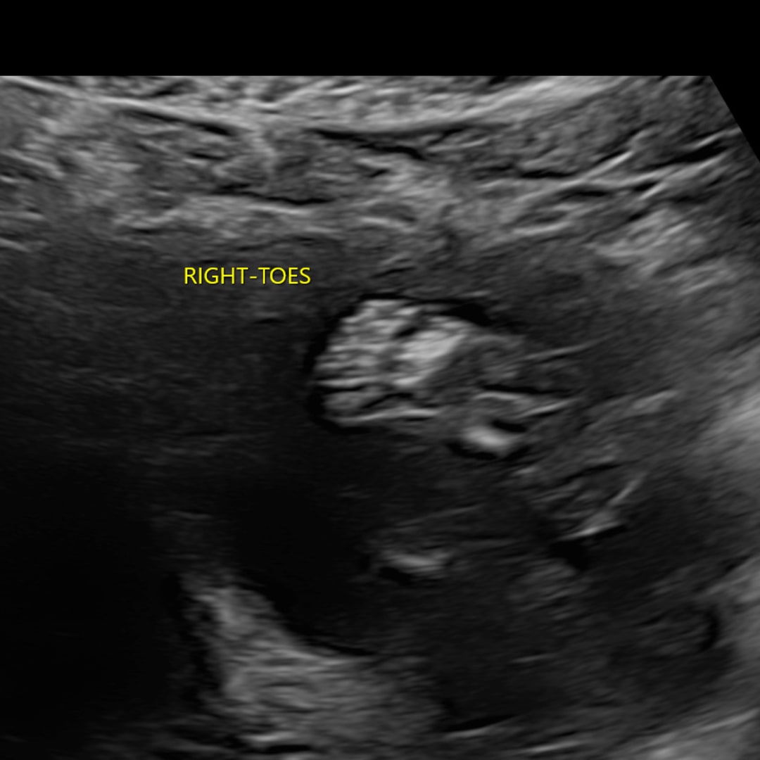 Photo shared by Brittnye for their Babylist baby registry.