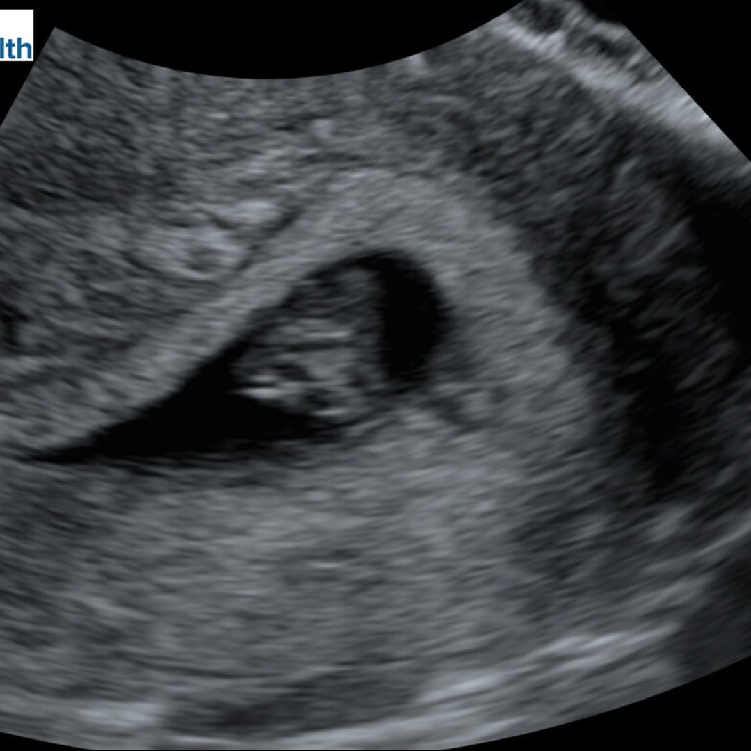Photo shared by Adriana for their Babylist baby registry.