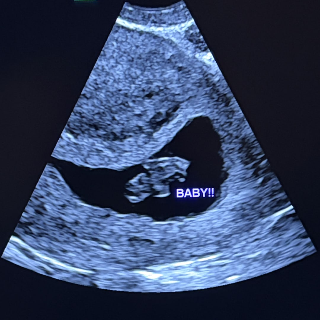 Photo shared by Santinia for their Babylist baby registry.