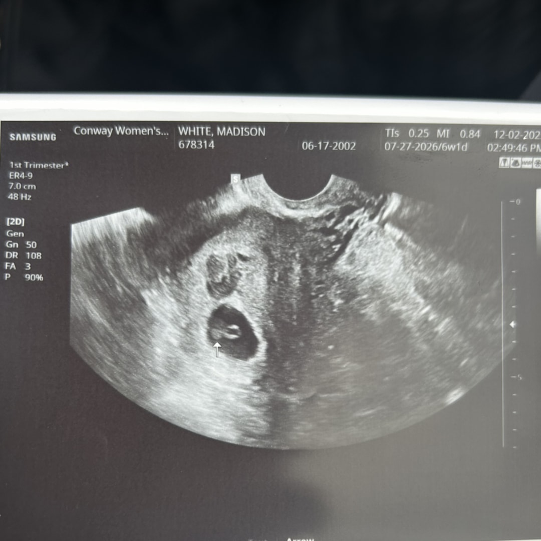 Photo shared by Madison for their Babylist baby registry.