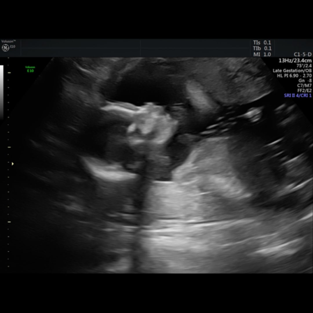 Photo shared by Jordan for their Babylist baby registry.