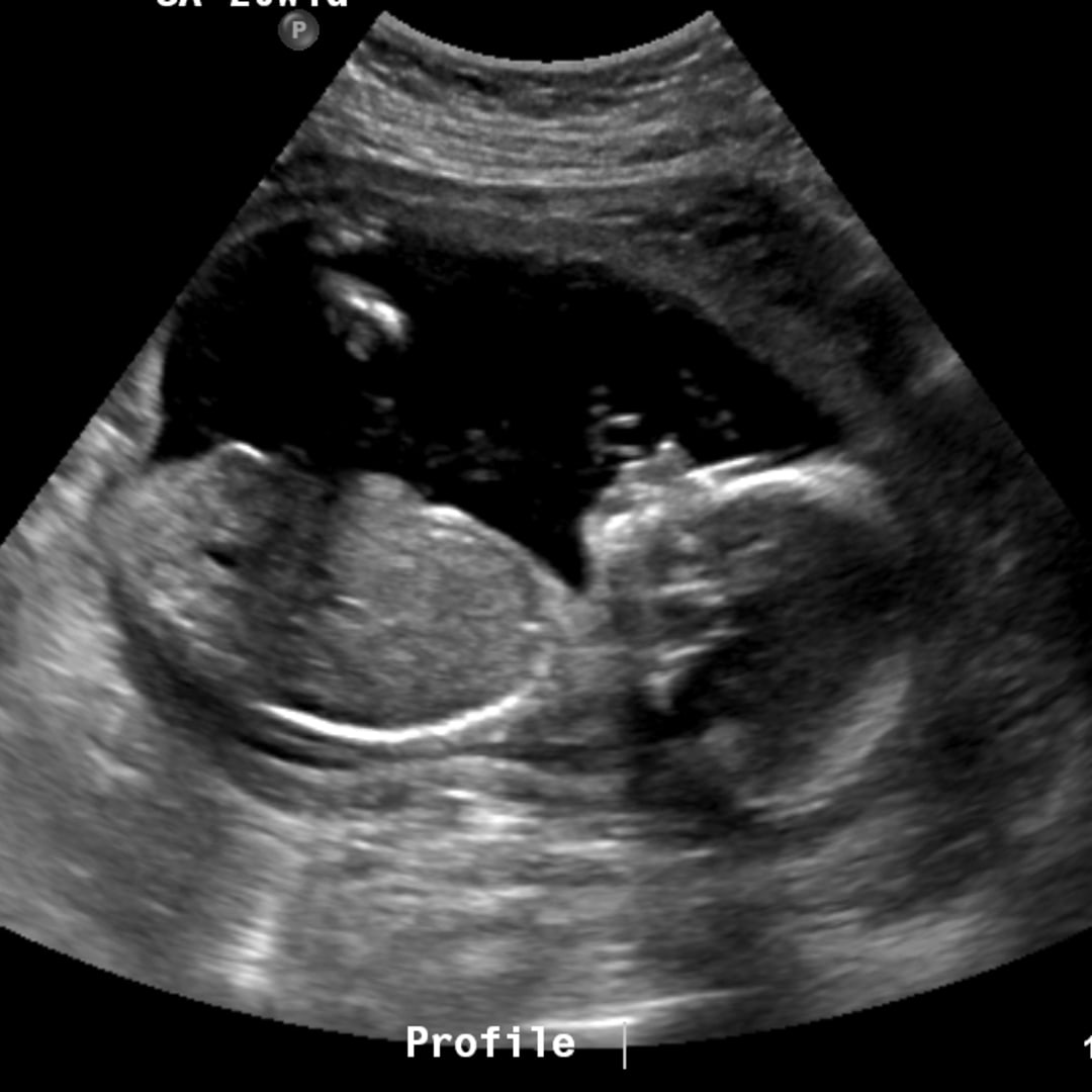 Photo shared by Kinley for their Babylist baby registry.