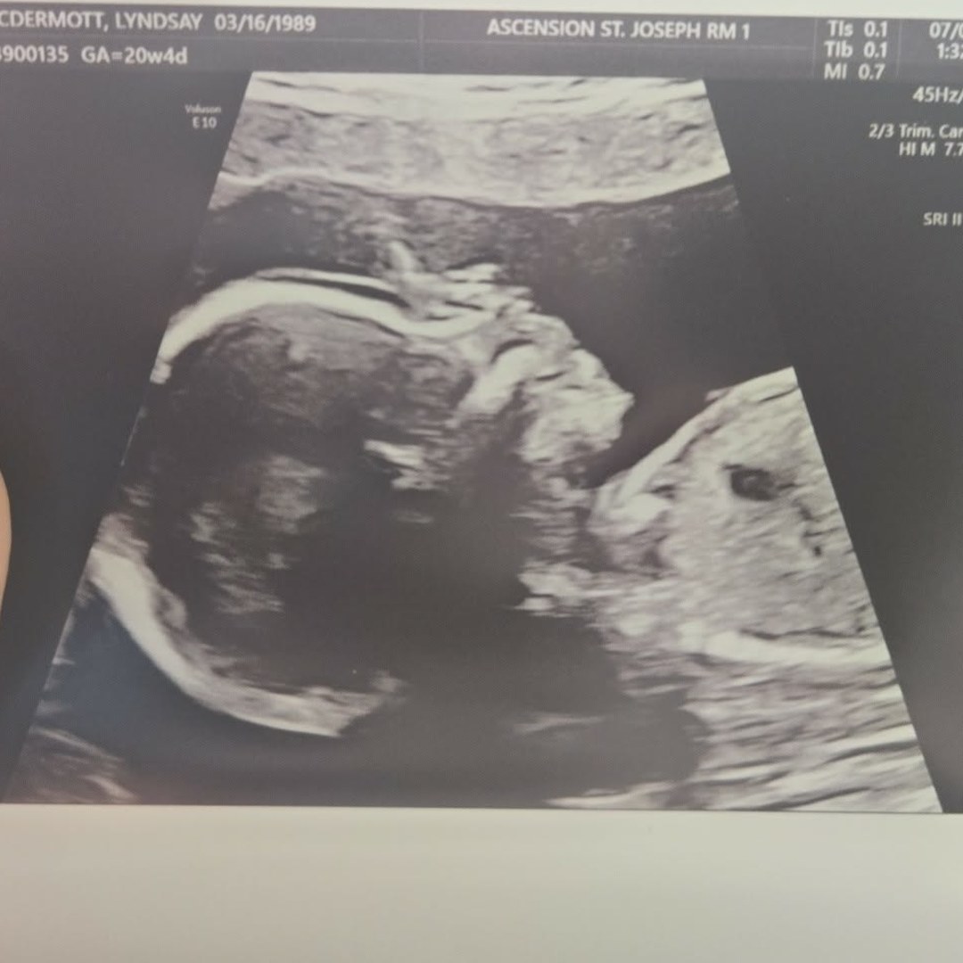 Photo shared by Lyndsay for their Babylist baby registry.