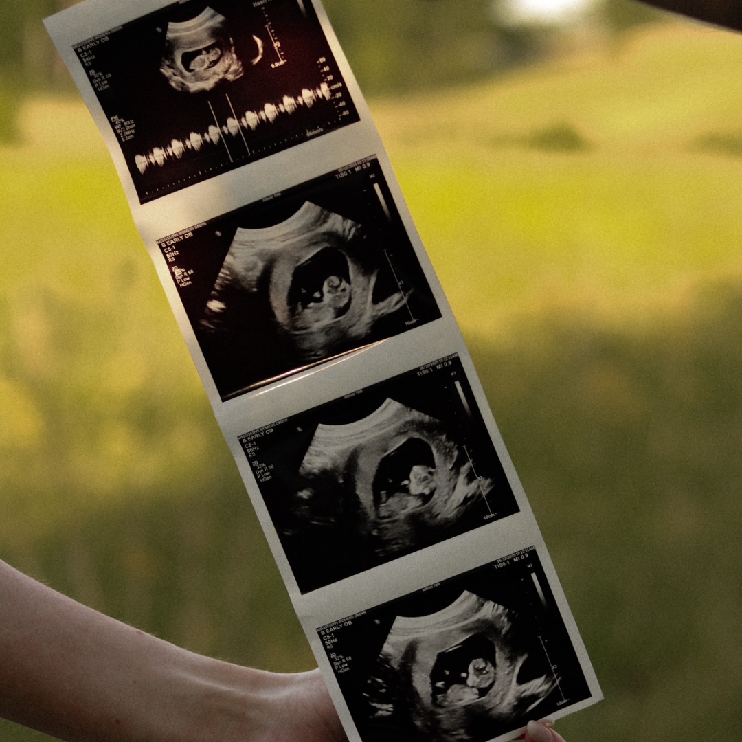 Photo shared by Anna Klaire for their Babylist baby registry.