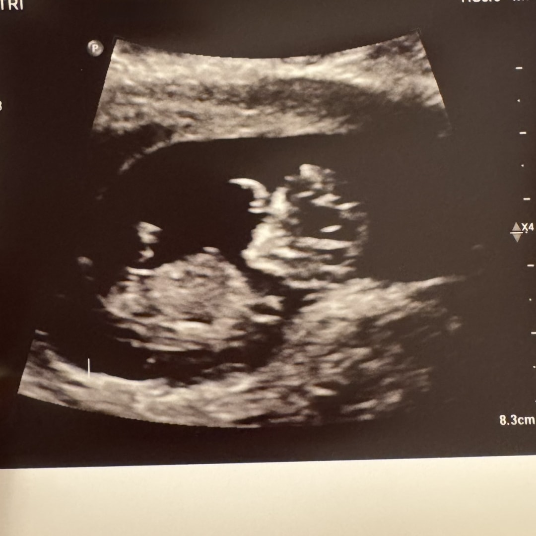 Photo shared by Mayra for their Babylist baby registry.