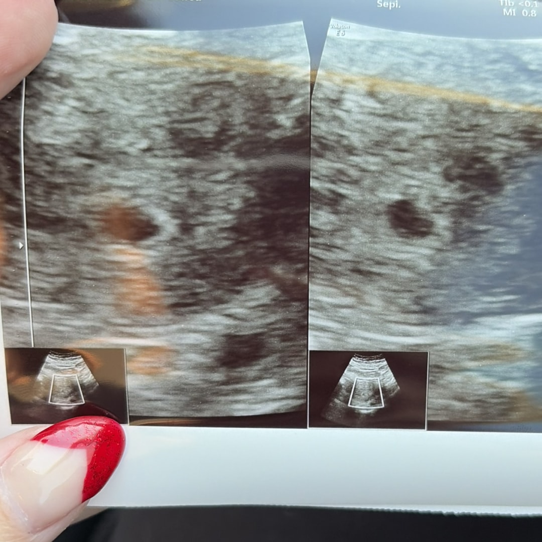 Photo shared by Natalee for their Babylist baby registry.