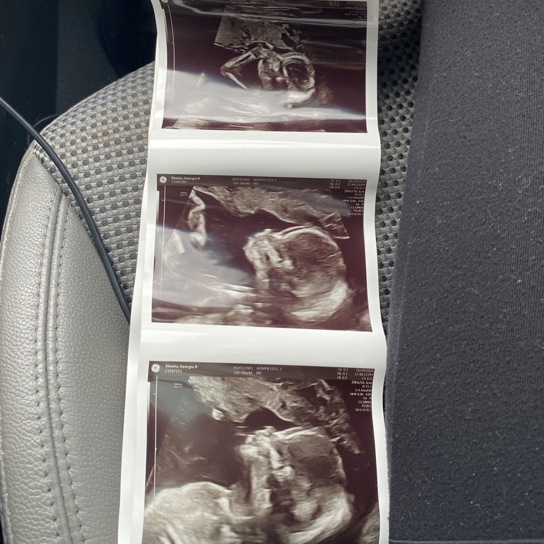 Photo shared by Georgia for their Babylist baby registry.