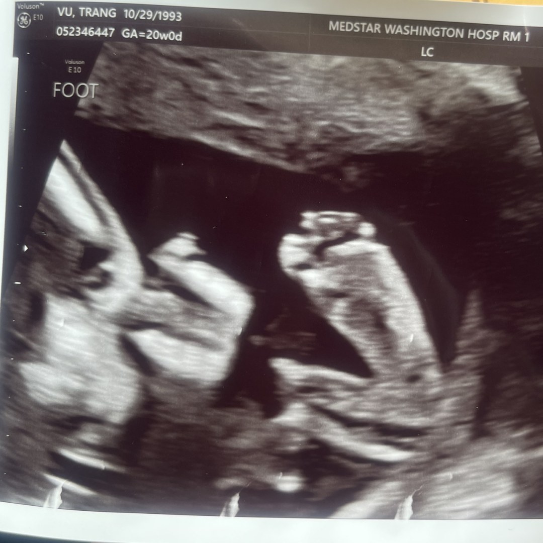 Photo shared by Trang for their Babylist baby registry.