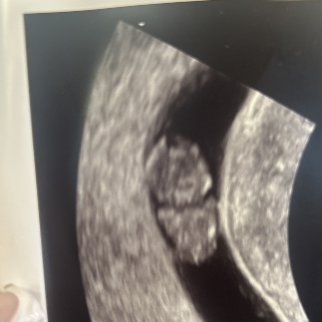 Photo shared by Alaysia for their Babylist baby registry.
