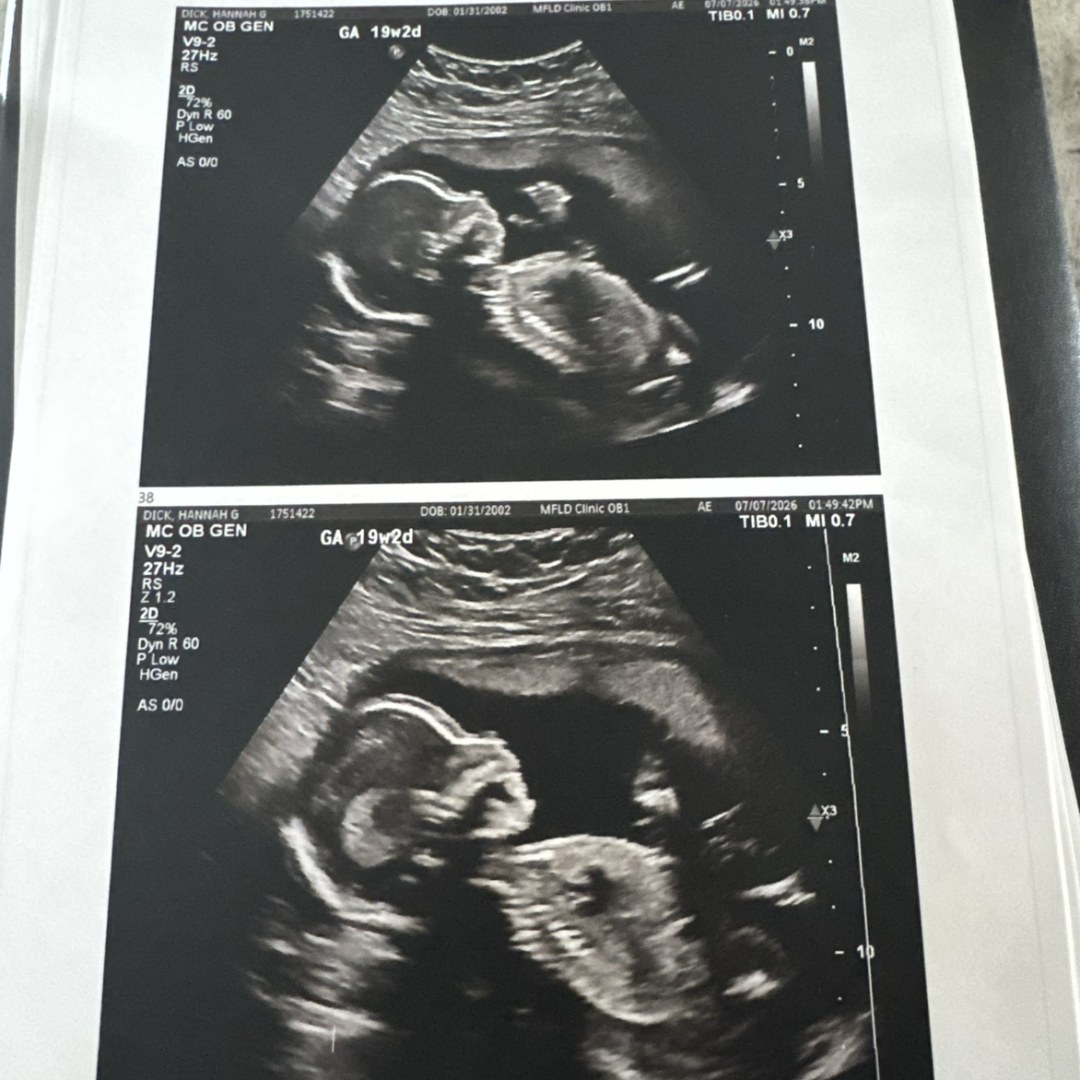 Photo shared by Hannah for their Babylist baby registry.