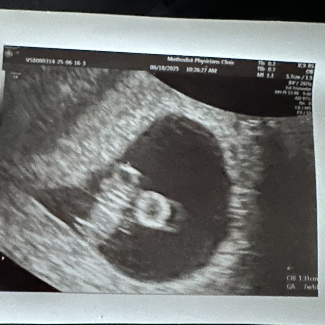 Photo shared by Kayleigh for their Babylist baby registry.