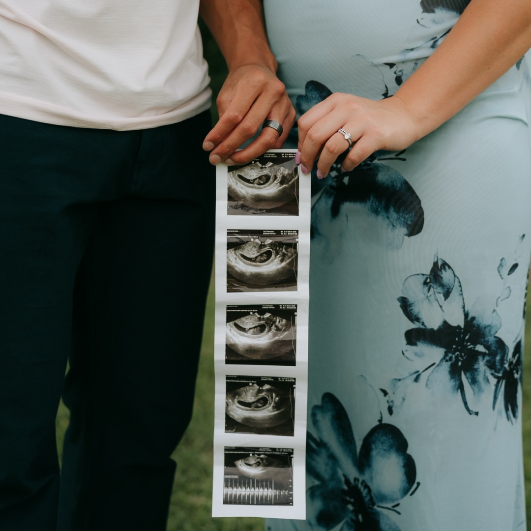 Photo shared by Brooklyn for their Babylist baby registry.
